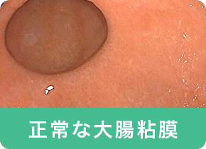 正常な大腸粘膜